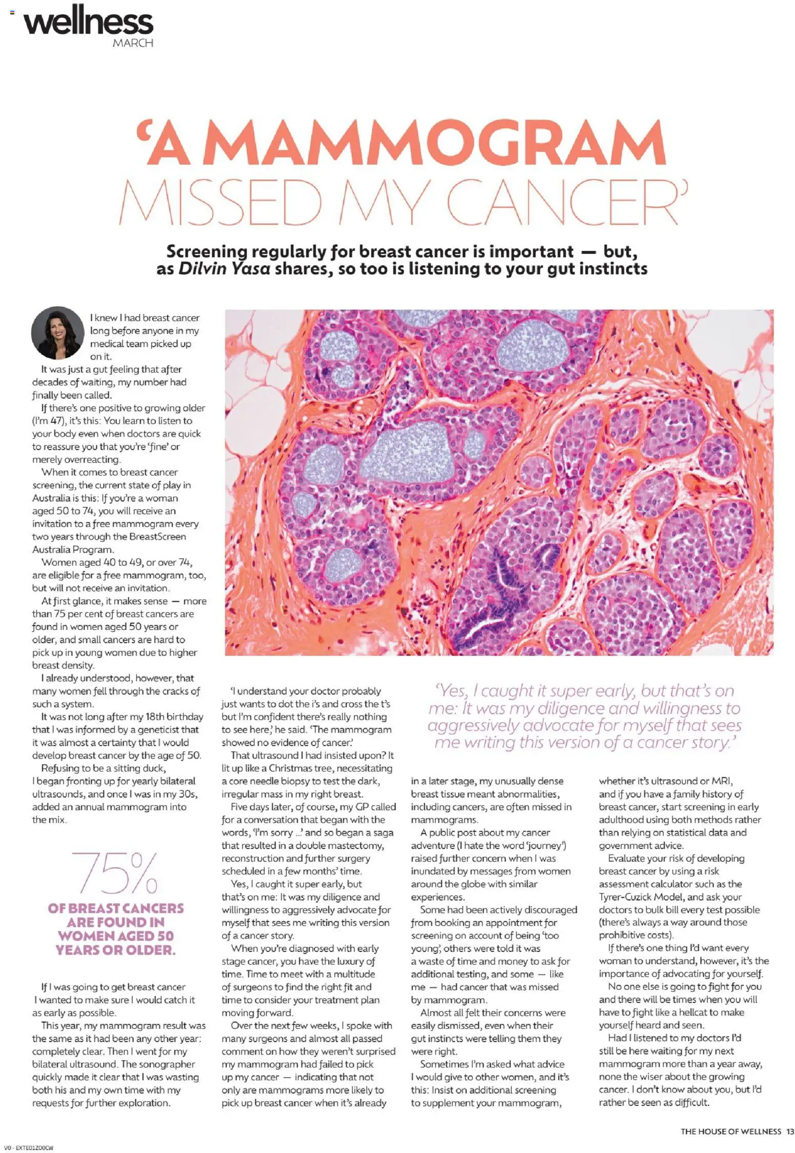 Chemist Warehouse catalogue - valid from 12.03.2026 | Page: 13 | Products: Calculator, Treatment