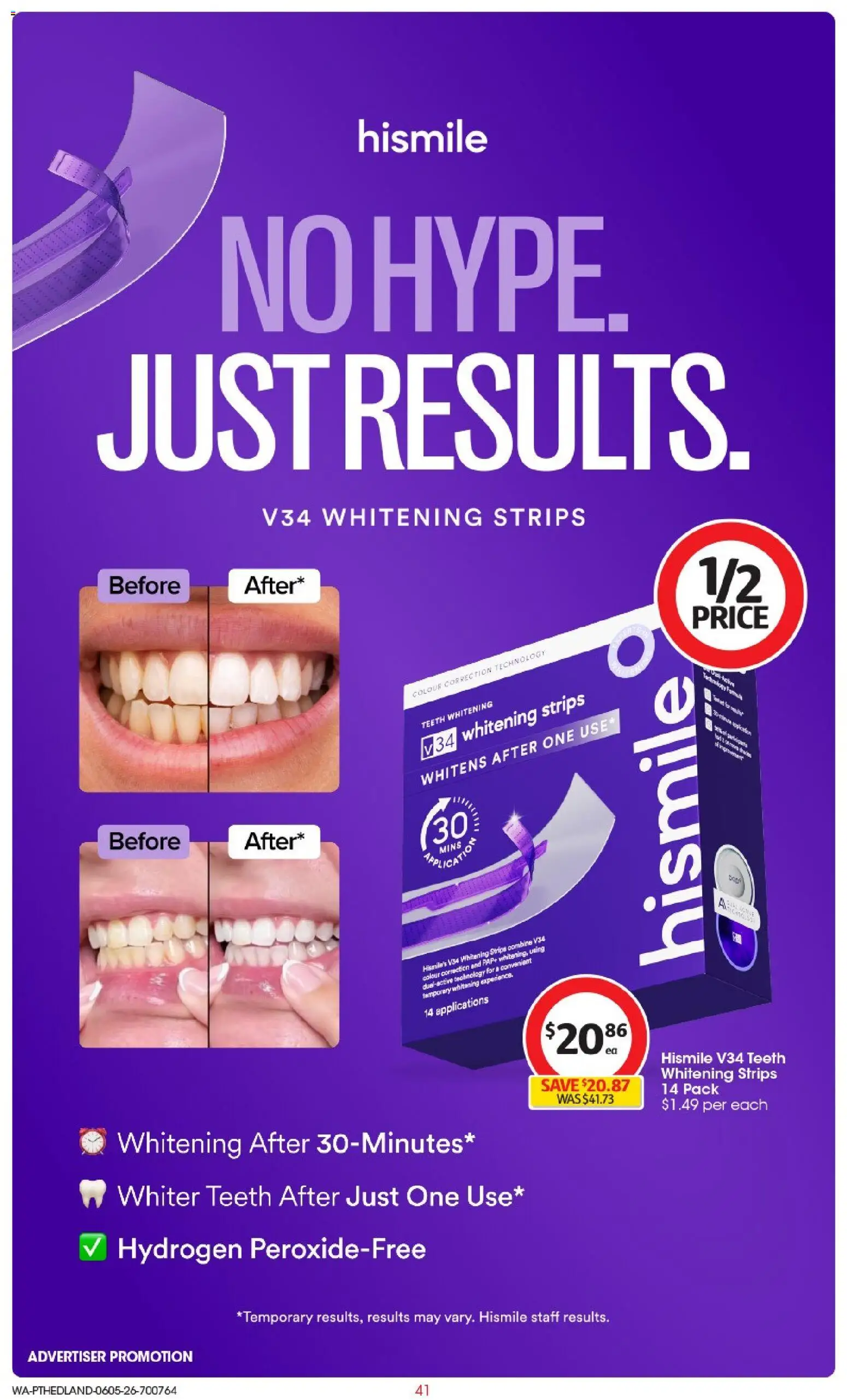 Coles catalogue - valid from 06.05.2026 | Page: 41 | Products: Teeth whitening